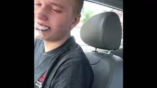 Andy Wisdom Teeth