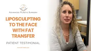 Patient Testimonial - Liposculpting to the face with fat grafting to the lips