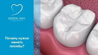 Почему нужно менять пломбы ?