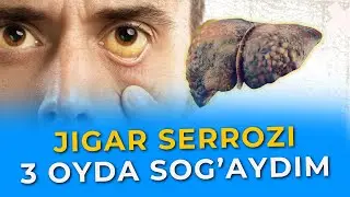 Jigar Serrozi Davolash | Uy Sharoitida