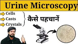 Microscopic Examination of Urine || Urine Analysis in Hindi || Crystals || Casts || Lab Practical