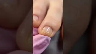 Педикюр с ремувером 