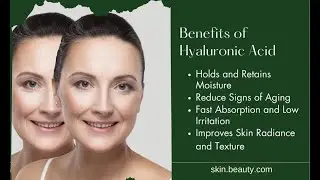 Hyaluronic Acid- Benefits for Skin Health