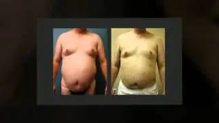 Plastic Surgeon Twin Falls ID