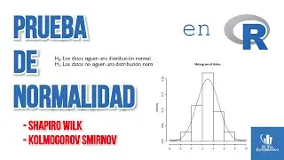 Cómo hacer la PRUEBA DE NORMALIDAD ✅ en R 🔥🔥