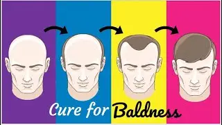 Treat baldness with this oil | Oil for treat Baldness | Castor oil for Hair Growth | Treat alopecia