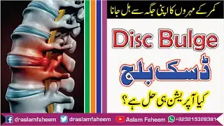 How to Treat Disc Bulge ? | What is Lumbar Disc Herniation? | Bulging Discs, Causes and Treatment