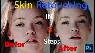 How To Remove Skin Blemishes In Photoshop | How To Remove Face Dark Spots In Adobe Photoshop | 2020
