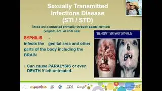 Understanding the Self | The Sexual Self | Sexually Transmitted Infection