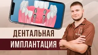 ДЕНТАЛЬНАЯ ИМПЛАНТАЦИЯ: современное решение для ВОССТАНОВЛЕНИЯ ЗУБОВ