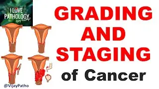 NEOPLASIA Part 11: GRADING and STAGING of cancer