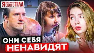 ОБЗИРАЮ Я СТЕСНЯЮСЬ СВОЕГО ТЕЛА