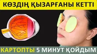 КӨЗ ҚЫЗАРҒАНЫН БАСУ ҮШІН 20 МИНУТ ОСЫНЫ ЖАСАҢЫЗ, Көз қызарса не істейміз, Керек арнасы