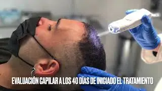 Plan de Recuperación Capilar. Resultados a 40 días. Clínica Merced 👩‍⚕️👨‍⚕️
