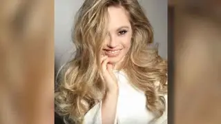 Minnesota woman hopes to become first Sports Illustrated swimsuit model with Down syndrome