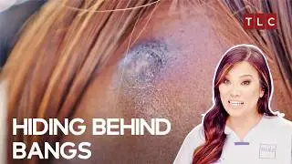 Behind the Wig and Behind the Pain Dr Lee Finds the Real Person | Dr Pimple Popper S3 E4 | TLC India