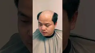 beautiful baldman, When getting new hair 