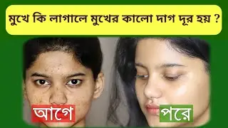 মুখে কি লাগালে মুখের কালো দাগ দূর হয়\ধাঁধা প্রশ্ন ও উত্তর \গুগলি প্রশ্ন ও উত্তর\quiz\buddhir khela