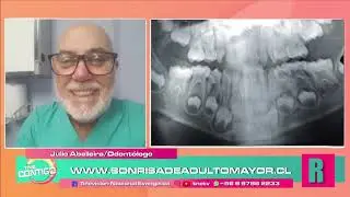 FRACTURAS Y LESIONES DENTALES   Dr. Julio Abelleira "Sonrisa de Adulto Mayor"