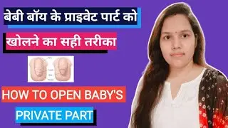 How To Open Baby Boy Private Part| बेबी बॉय का सुसु कैसे खोले |बेबी बॉय का प्राइवेट पार्ट कैसे खोलें