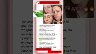 Избавиться от акне с помощью истоков чистоты от #siberianwellness