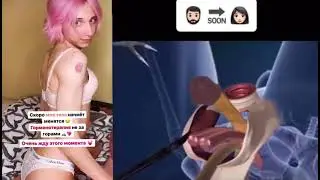 Даша Корейка меняет пол!