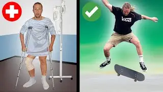 Return to Skateboarding After Surgery