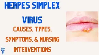 HERPES SIMPLEX VIRUS Nursing Interventions, Causes, & Types