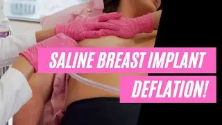 Saline Breast Implant Deflation / Houston Plastic Surgery / Saline Breast Implant