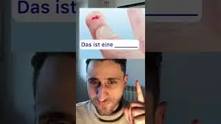 Verletzungen auf Deutsch 🇩🇪 #deutschlernen
