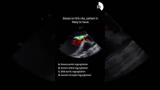 Echocardiography board practice question #13