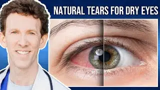 PRP Treatment for Dry Eyes with Dr. Scheiner | Ms. Dawson's Testimonial