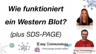 Methoden: Wie funktioniert der Western Blot? (und was ist eine SDS-PAGE eigentlich?)