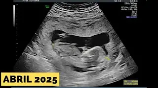 BEBÉ EN CAMINO! Abril 2025