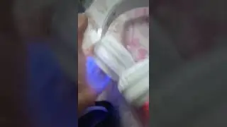 у меня др