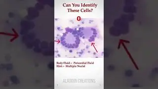 Can you identify these Cells In Body Fluid ? 🧐🙄🤔 #Quiz 393