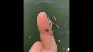 How to remove a treble hook from your finger with no pain