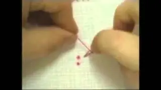 French Knots