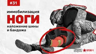 Как иммобилизировать НОГУ с помощью шины и бандажа (ТЕМА №31)