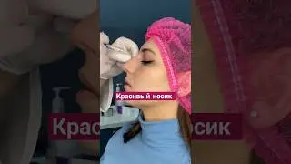 Как убрать горбинку на носу?