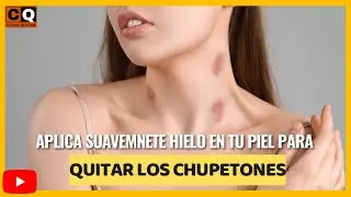 Como QUITAR CHUPETONES con HIELO | Aprende a quitar un CHUPETON RÁPIDO