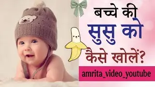 Baby Boy susu opening | Baby Susu Opening Process | Susu Kaise Khola Jata Hai Practical | Susu Open 