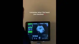 I remember when i first heard your heart beat