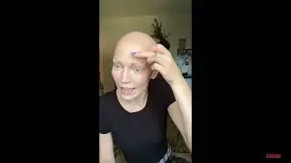 Makeup for Alopecia