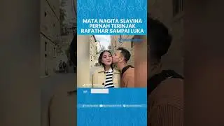 Curhat Nagita Slavina Matanya Terinjak Rafathar sampai Lapisan Mata Sobek, Kini Jadi Lebih Sensitif
