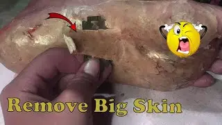 How to removal skin | callus removal skin flakes #43