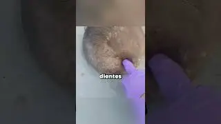 Glitch de gemelos