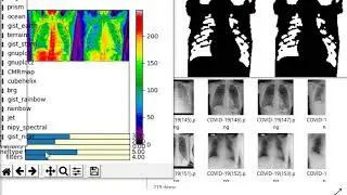 covid19radiographytestrun