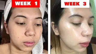 My Brilliant Skin Story + Tips + Fake or Legit?