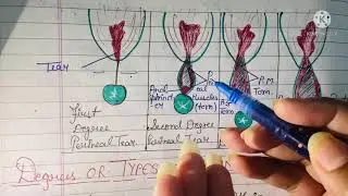 Episiotomy Full Lecture || Episiotomy or Perineotomy Lecture || Sandhya OBG Study Point